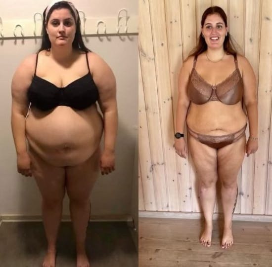 Trine før og efter sit vægttab
