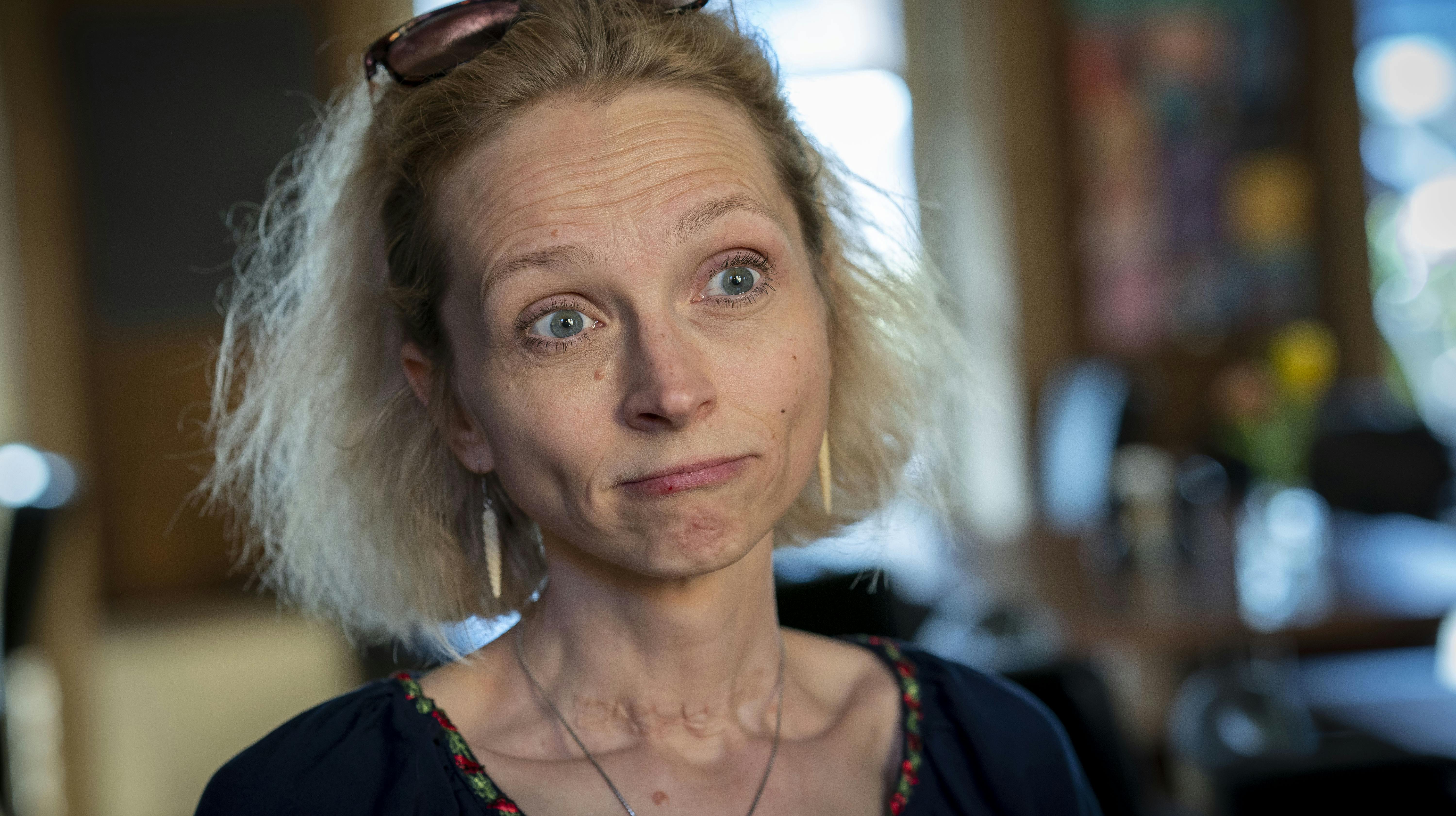 Matilde Kimer.