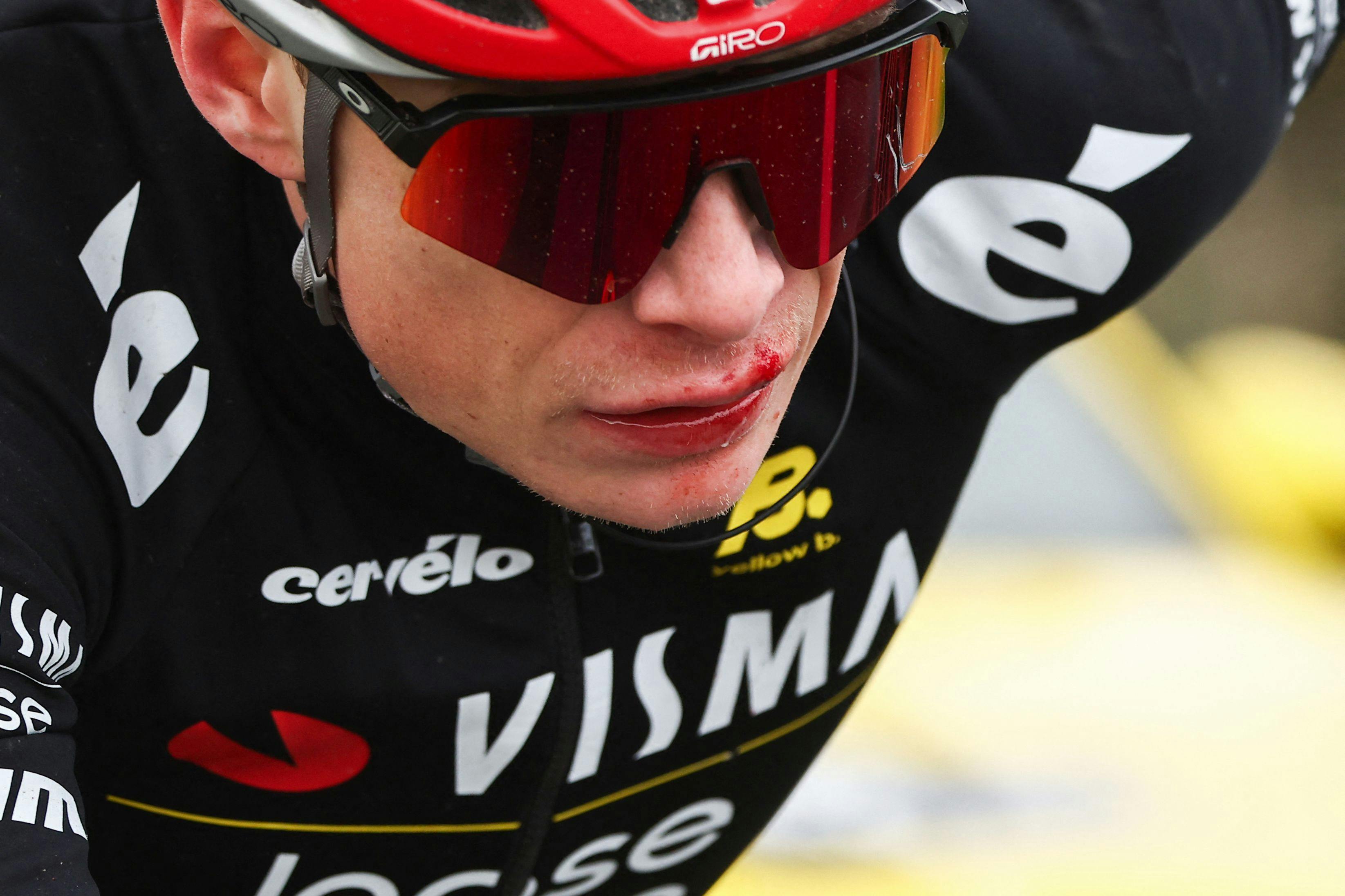 Team Visma-Lease a Bike's Danish rider Jonas Vingegaard reacts as he cycles after falling during the 5th stage of the Paris-Nice cycling race, 196, 5 km between Saint-Just-en-Chevalet and La C. (Foto: ANNE-CHRISTINE POUJOULAT/Ritzau Scanpix)