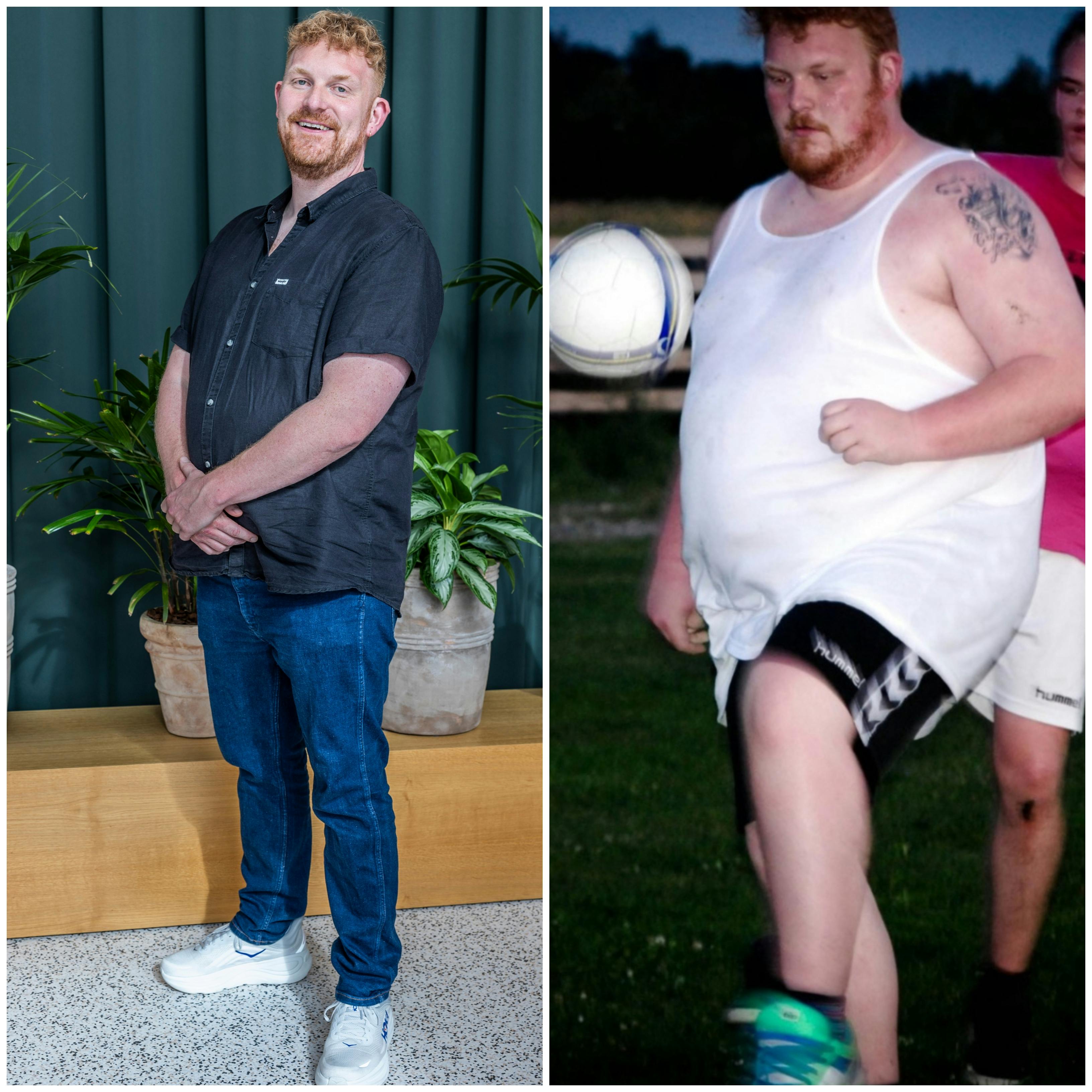 Guido før og efter vægttabet.