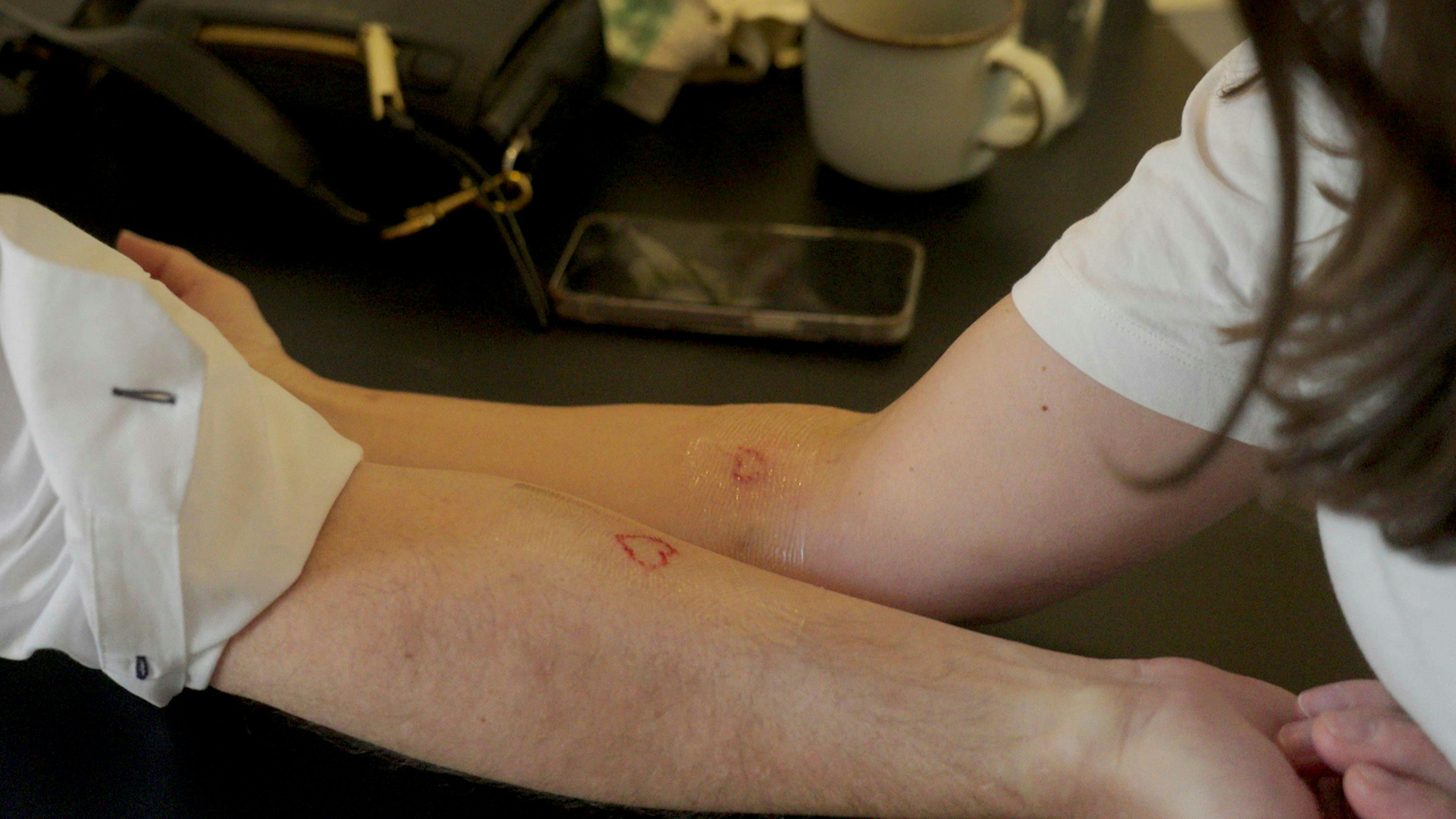 Mette og Thomas fik i sidste afsnit lavet ens tatoveringer.
