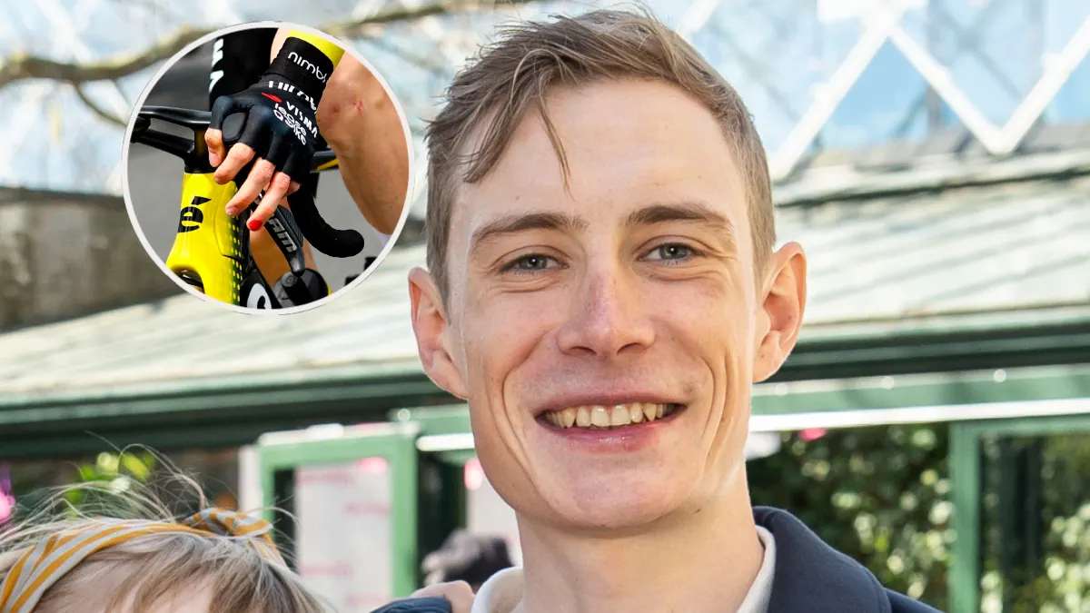 Jonas Vingegaard har lakeret en negl rød: Årsagen rammer lige i hjertekulen  | BILLED-BLADET