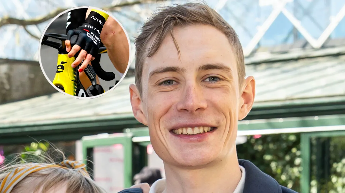Jonas Vingegaard har lakeret en negl rød: Årsagen rammer lige i hjertekulen | BILLED-BLADET