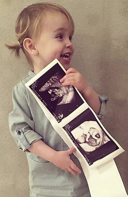 Ditte Julie Jensens datter Karla holder et scanningsbillede af sin lillebror. 
