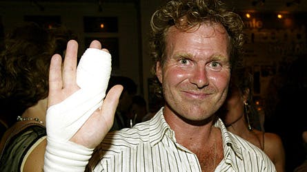 Stuntmanden Lasse Spang Olsen viser ved en tidligere lejlighed den brækkede finger. Den var lige vokset sammen, inden han tog af sted til tv-optagelserne.