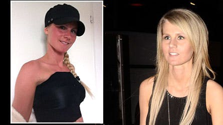 Putte som vi plejer at se hende i "Singleliv" - til venstre er viser hun sit nye forparti umiddelbart efter operationen.